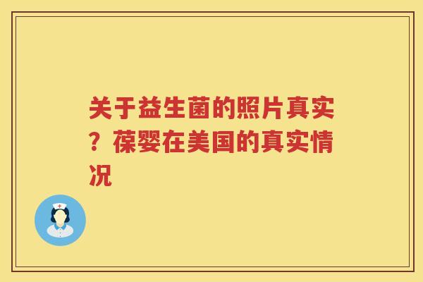 关于益生菌的照片真实？葆婴在美国的真实情况