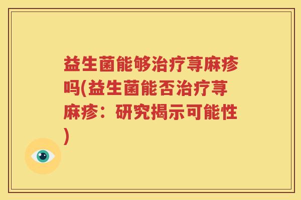 益生菌能够治疗荨麻疹吗(益生菌能否治疗荨麻疹：研究揭示可能性)